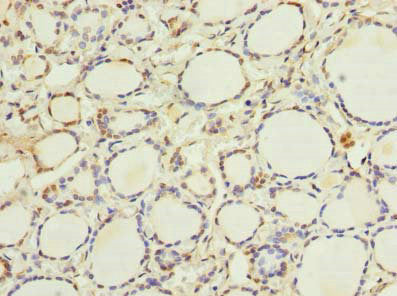 Immunohistochemistry of paraffin-embedded human thyroid tissue using ETNK1 Antibody at dilution of 1:100Rabbit anti-Human ETNK1 Polyclonal Antibody