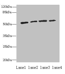 Western blot  | All lanes: ETNK1 antibody at 0.5µg/ml  | Lane 1: A549 whole cell lysate  | Lane 2: A431 whole cell lysate  | Lane 3: HepG2 whole cell lysate  | Lane 4: MCF-7 whole cell lysate  | Secondary  | Goat polyclonal to rabbit IgG at 1/10000 dilution  | Predicted band size: 51, 28 kDa  | Observed band size: 51 kDaRabbit anti-Human ETNK1 Polyclonal Antibody