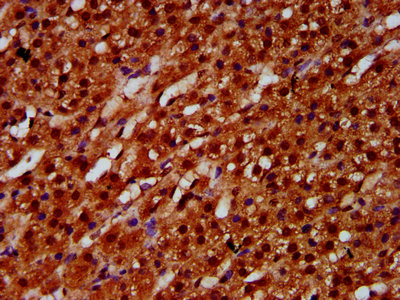 IHC image of ETV5 Antibody diluted at 1:600 and staining in paraffin-embedded human adrenal gland tissue performed on a Leica BondTM system. After dewaxing and hydration, antigen retrieval was mediated by high pressure in a citrate buffer (pH 6.0). Section was blocked with 10% normal goat serum 30min at RT. Then primary antibody (1% BSA) was incubated at 4°C overnight. The primary is detected by a biotinylated secondary antibody and visualized using an HRP conjugated SP system.Rabbit anti-Human ETV5 Polyclonal Antibody