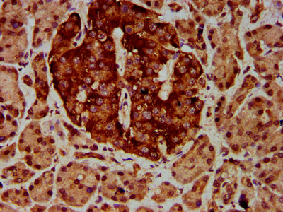 IHC image of ETV5 Antibody diluted at 1:600 and staining in paraffin-embedded human pancreatic tissue performed on a Leica BondTM system. After dewaxing and hydration, antigen retrieval was mediated by high pressure in a citrate buffer (pH 6.0). Section was blocked with 10% normal goat serum 30min at RT. Then primary antibody (1% BSA) was incubated at 4°C overnight. The primary is detected by a biotinylated secondary antibody and visualized using an HRP conjugated SP system.Rabbit anti-Human ETV5 Polyclonal Antibody