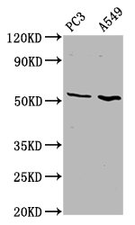 Western Blot  | Positive WB detected in: PC-3 whole cell lysate, A549 whole cell lysate  | All lanes: ETV5 antibody at 4.6µg/ml  | Secondary  | Goat polyclonal to rabbit IgG at 1/50000 dilution  | Predicted band size: 58, 63 kDa  | Observed band size: 58 kDaRabbit anti-Human ETV5 Polyclonal Antibody