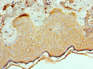 Immunohistochemistry of paraffin-embedded human skin tissue using ETV6 Antibody at dilution of 1:100Rabbit anti-Human ETV6 Polyclonal Antibody