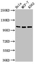 Western Blot | Positive WB detected in: Hela whole cell lysate, MCF-7 whole cell lysate, K562 whole cell lysate | All lanes: EVC antibody at 2μg/ml | Secondary | Goat polyclonal to rabbit IgG at 1/50000 dilution | Predicted band size: 112 kDa | Observed band size: 112 kDaRabbit anti-Human EVC Polyclonal Antibody