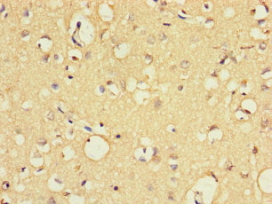 Immunohistochemistry of paraffin-embedded human brain tissue using EXO1 Antibody at dilution of 1:100Rabbit anti-Human EXO1 Polyclonal Antibody