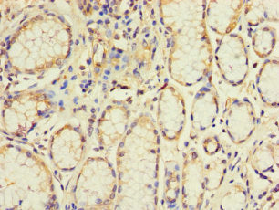 Immunohistochemistry of paraffin-embedded human stomach tissue using EXO1 Antibody at dilution of 1:100Rabbit anti-Human EXO1 Polyclonal Antibody