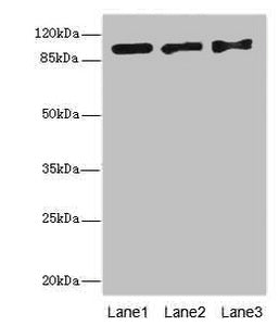 Western blot | All lanes: EXO1 antibody at 10μg/ml | Lane 1: Hela whole cell lysate | Lane 2: 293T whole cell lysate | Lane 3: A549 whole cell lysate | Secondary | Goat polyclonal to rabbit IgG at 1/10000 dilution | Predicted band size: 95, 90 kDa | Observed band size: 95 kDaRabbit anti-Human EXO1 Polyclonal Antibody