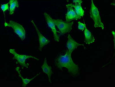 Immunofluorescence staining of U251 cells with EXOC7 Antibody at 1:186, counter-stained with DAPI. The cells were fixed in 4% formaldehyde, permeabilized using 0.2% Triton X-100 and blocked in 10% normal Goat Serum. The cells were then incubated with the antibody overnight at 4°C. The secondary antibody was Alexa Fluor 488-congugated AffiniPure Goat Anti-Rabbit IgG(H+L).Rabbit anti-Human EXOC7 Polyclonal Antibody