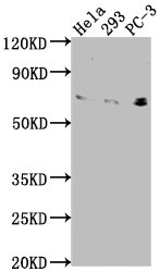 Western Blot | Positive WB detected in: Hela whole cell lysate, 293 whole cell lysate, PC-3 whole cell lysate | All lanes: EXOC7 antibody at 1:2000 | Secondary | Goat polyclonal to rabbit IgG at 1/50000 dilution | Predicted band size: 84, 79, 75, 33, 78, 81 kDa | Observed band size: 75 kDaRabbit anti-Human EXOC7 Polyclonal Antibody