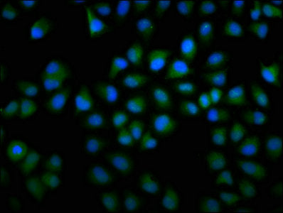 Immunofluorescence staining of Hela cells with F13A1 Antibody at 1:166, counter-stained with DAPI. The cells were fixed in 4% formaldehyde, permeabilized using 0.2% Triton X-100 and blocked in 10% normal Goat Serum. The cells were then incubated with the antibody overnight at 4°C. The secondary antibody was Alexa Fluor 488-congugated AffiniPure Goat Anti-Rabbit IgG(H+L).Rabbit anti-Human F13A1 Polyclonal Antibody