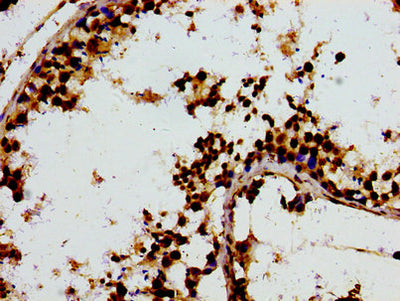 Immunohistochemistry of paraffin-embedded human testis tissue using F13A1 Antibody at dilution of 1:100Rabbit anti-Human F13A1 Polyclonal Antibody