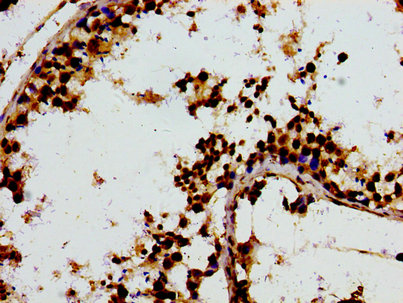 Immunohistochemistry of paraffin-embedded human testis tissue using F13A1 Antibody at dilution of 1:100Rabbit anti-Human F13A1 Polyclonal Antibody