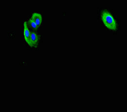 Immunofluorescent analysis of HepG2 cells using F2R Antibody at dilution of 1:100 and Alexa Fluor 488-congugated AffiniPure Goat Anti-Rabbit IgG(H+L)Rabbit anti-Human F2R Polyclonal Antibody