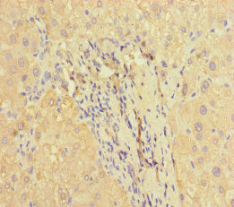 Immunohistochemistry of paraffin-embedded human liver tissue using F2R Antibody at dilution of 1:100Rabbit anti-Human F2R Polyclonal Antibody