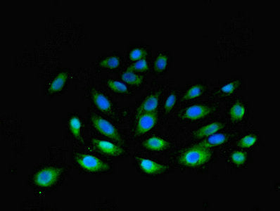 Immunofluorescent analysis of A549 cells using F3 Antibody at dilution of 1:100 and Alexa Fluor 488-congugated AffiniPure Goat Anti-Rabbit IgG(H+L)Rabbit anti-Human F3 Polyclonal Antibody