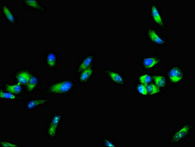 Immunofluorescent analysis of Hela cells using F8 Antibody at dilution of 1:100 and Alexa Fluor 488-congugated AffiniPure Goat Anti-Rabbit IgG(H+L)Rabbit anti-Human F8 Polyclonal Antibody