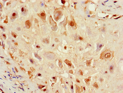 Immunohistochemistry of paraffin-embedded human placenta tissue using the antibody at dilution of 1:100Rabbit anti-Human F8 Polyclonal Antibody