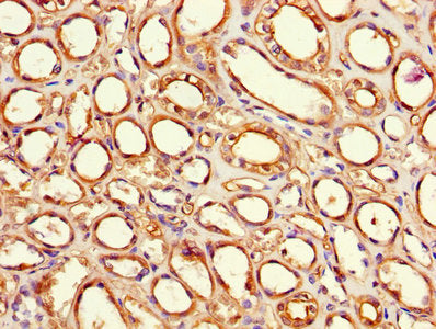 Immunohistochemistry of paraffin-embedded human kidney tissue using F8 Antibody at dilution of 1:100Rabbit anti-Human F8 Polyclonal Antibody