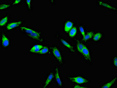 Immunofluorescent analysis of Hela cells using F9 Antibody at dilution of 1:100 and Alexa Fluor 488-congugated AffiniPure Goat Anti-Rabbit IgG(H+L)Rabbit anti-Human F9 Polyclonal Antibody