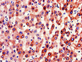 Immunohistochemistry of paraffin-embedded human liver tissue using the antibody at dilution of 1:100Rabbit anti-Human F9 Polyclonal Antibody