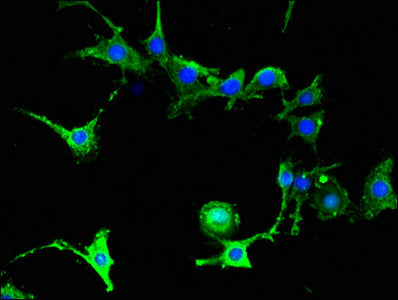 Immunofluorescent analysis of MCF-7 cells using FAAH Antibody at dilution of 1:100 and Alexa Fluor 488-congugated AffiniPure Goat Anti-Rabbit IgG(H+L)Rabbit anti-Human FAAH Polyclonal Antibody