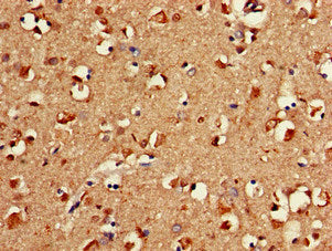 Immunohistochemistry of paraffin-embedded human brain tissue using the antibody at dilution of 1:100Rabbit anti-Human FAAH Polyclonal Antibody