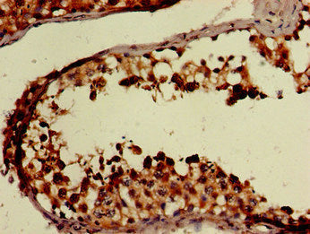 Immunohistochemistry of paraffin-embedded human testis tissue using FAAH Antibody at dilution of 1:100Rabbit anti-Human FAAH Polyclonal Antibody