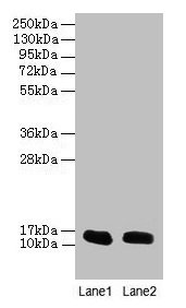 Western blot  | All lanes: FABP1 antibody at 16µg/ml  | Lane 1: Mouse liver tissue  | Lane 2: Mouse small intestine tissue  | Secondary  | Goat polyclonal to rabbit IgG at 1/10000 dilution  | Predicted band size: 15 kDa  | Observed band size: 15 kDaRabbit anti-Human FABP1 Polyclonal Antibody