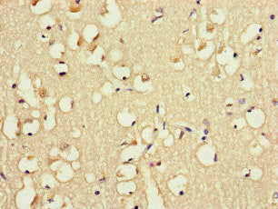 Immunohistochemistry of paraffin-embedded human brain tissue using the antibody at dilution of 1:100Rabbit anti-Human FABP7 Polyclonal Antibody
