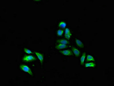 Immunofluorescent analysis of HepG2 cells using FADS1 Antibody at dilution of 1:100 and Alexa Fluor 488-congugated AffiniPure Goat Anti-Rabbit IgG(H+L)Rabbit anti-Human FADS1 Polyclonal Antibody