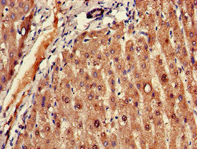 Immunohistochemistry of paraffin-embedded human liver tissue using the antibody at dilution of 1:100Rabbit anti-Human FADS1 Polyclonal Antibody