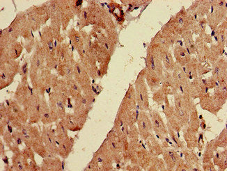 Immunohistochemistry of paraffin-embedded human heart tissue using FADS1 Antibody at dilution of 1:100Rabbit anti-Human FADS1 Polyclonal Antibody