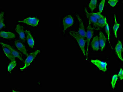 Immunofluorescent analysis of Hela cells using FAH Antibody at dilution of 1:100 and Alexa Fluor 488-congugated AffiniPure Goat Anti-Rabbit IgG(H+L)Rabbit anti-Human FAH Polyclonal Antibody