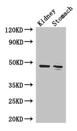 Western Blot  | Positive WB detected in: Mouse kidney tissue, Mouse stomach tissue  | All lanes: FAH antibody at 3.4µg/ml  | Secondary  | Goat polyclonal to rabbit IgG at 1/50000 dilution  | Predicted band size: 47, 39 kDa  | Observed band size: 47 kDaRabbit anti-Human FAH Polyclonal Antibody