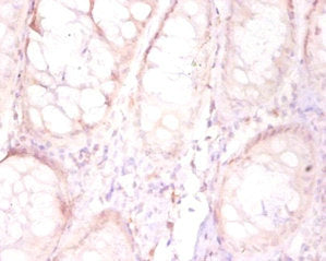 Immunohistochemistry of paraffin-embedded human placenta tissue using FAM110B Antibody at dilution of 1:50Rabbit anti-Human FAM110B Polyclonal Antibody
