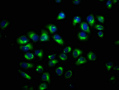 Immunofluorescence staining of Hela cells with TCAF2 Antibody at 1:100, counter-stained with DAPI. The cells were fixed in 4% formaldehyde, permeabilized using 0.2% Triton X-100 and blocked in 10% normal Goat Serum. The cells were then incubated with the antibody overnight at 4°C. The secondary antibody was Alexa Fluor 488-congugated AffiniPure Goat Anti-Rabbit IgG(H+L).Rabbit anti-Human TCAF2 Polyclonal Antibody