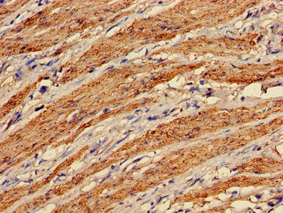 Immunohistochemistry of paraffin-embedded human smooth muscle tissue using TAGLN Antibody at dilution of 1:100Rabbit anti-Human TAGLN Polyclonal Antibody