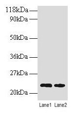Western blot  | All lanes: TAGLN antibody at 2µg/ml  | Lane 1: EC109 whole cell lysate  | Lane 2: 293T whole cell lysate  | Secondary  | Goat polyclonal to rabbit IgG at 1/15000 dilution  | Predicted band size: 23 kDa  | Observed band size: 23 kDaRabbit anti-Human TAGLN Polyclonal Antibody
