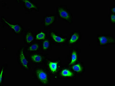 Immunofluorescent analysis of A549 cells using FAM168B Antibody at dilution of 1:100 and Alexa Fluor 488-congugated AffiniPure Goat Anti-Rabbit IgG(H+L)Rabbit anti-Human FAM168B Polyclonal Antibody