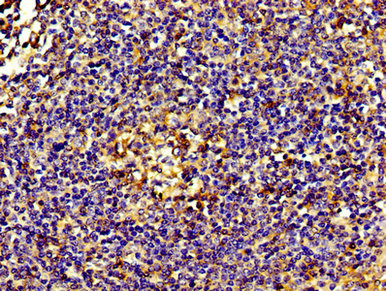 IHC image of ACTN4 Antibody diluted at 1:200 and staining in paraffin-embedded human tonsil tissue performed on a Leica BondTM system. After dewaxing and hydration, antigen retrieval was mediated by high pressure in a citrate buffer (pH 6.0). Section was blocked with 10% normal goat serum 30min at RT. Then primary antibody (1% BSA) was incubated at 4°C overnight. The primary is detected by a biotinylated secondary antibody and visualized using an HRP conjugated SP system.