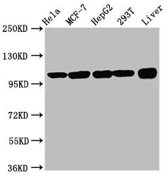 Western Blot  | Positive WB detected in: Hela whole cell lysate, MCF-7 whole cell lysate, HepG2 whole cell lysate, 293T whole cell lysate, Rat liver tissue  | All lanes: ACTN4 antibody at 3.3µg/ml  | Secondary  | Goat polyclonal to rabbit IgG at 1/50000 dilution  | Predicted band size: 105, 80, 60 kDa  | Observed band size: 105 kDa