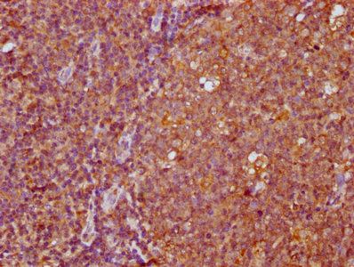 IHC image of FAM83G Antibody diluted at 1:400 and staining in paraffin-embedded human tonsil tissue performed on a Leica BondTM system. After dewaxing and hydration, antigen retrieval was mediated by high pressure in a citrate buffer (pH 6.0). Section was blocked with 10% normal goat serum 30min at RT. Then primary antibody (1% BSA) was incubated at 4°C overnight. The primary is detected by a biotinylated secondary antibody and visualized using an HRP conjugated SP system.Rabbit anti-Human FAM83G Polyclonal Antibody