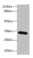 Western blot  | All lanes: FAM92A antibody at 1µg/ml + Mouse brain tissue  | Secondary  | Goat polyclonal to rabbit IgG at 1/10000 dilution  | Predicted band size: 34, 29, 32, 31, 12 kDa  | Observed band size: 34 kDaRabbit anti-Human FAM92A Polyclonal Antibody