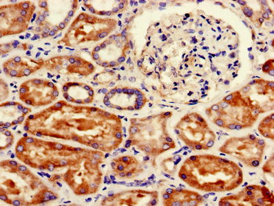 Immunohistochemistry of paraffin-embedded human kidney tissue using FANCC Antibody at dilution of 1:100Rabbit anti-Human FANCC Polyclonal Antibody