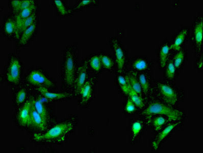 Immunofluorescent analysis of Hela cells using FARP2 Antibody at dilution of 1:100 and Alexa Fluor 488-congugated AffiniPure Goat Anti-Rabbit IgG(H+L)