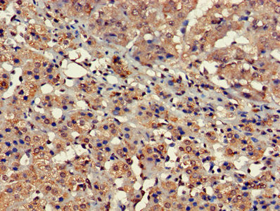 Immunohistochemistry of paraffin-embedded human adrenal gland tissue using FARP2 Antibody at dilution of 1:100