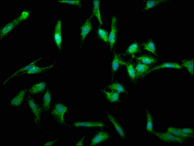 Immunofluorescence staining of Hela cells with FASLG Antibody at 1:330, counter-stained with DAPI. The cells were fixed in 4% formaldehyde, permeabilized using 0.2% Triton X-100 and blocked in 10% normal Goat Serum. The cells were then incubated with the antibody overnight at 4°C. The secondary antibody was Alexa Fluor 488-congugated AffiniPure Goat Anti-Rabbit IgG(H+L).Rabbit anti-Human FASLG Polyclonal Antibody