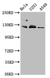 Western Blot  | Positive WB detected in: Hela whole cell lysate, U251 whole cell lysate, A549 whole cell lysate  | All lanes: FBLN2 antibody at 3.4µg/ml  | Secondary  | Goat polyclonal to rabbit IgG at 1/50000 dilution  | Predicted band size: 127, 132 kDa  | Observed band size: 127 kDaRabbit anti-Human FBLN2 Polyclonal Antibody