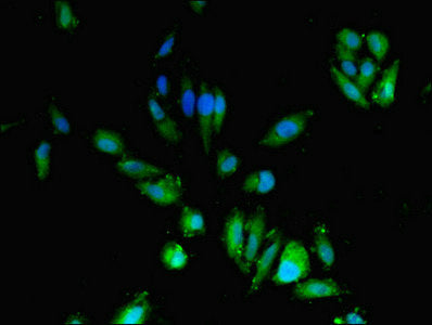 Immunofluorescent analysis of Hela cells using CDA Antibody at dilution of 1:100 and Alexa Fluor 488-congugated AffiniPure Goat Anti-Rabbit IgG(H+L)Rabbit anti-Human CDA Polyclonal Antibody