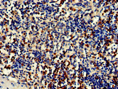 Immunohistochemistry of paraffin-embedded human spleen tissue using CDA Antibody at dilution of 1:100Rabbit anti-Human CDA Polyclonal Antibody