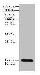 Western blot  | All lanes: CDA antibody at 2µg/ml + 293T whole cell lysate  | Secondary  | Goat polyclonal to rabbit IgG at 1/10000 dilution  | Predicted band size: 17 kDa  | Observed band size: 17 kDaRabbit anti-Human CDA Polyclonal Antibody